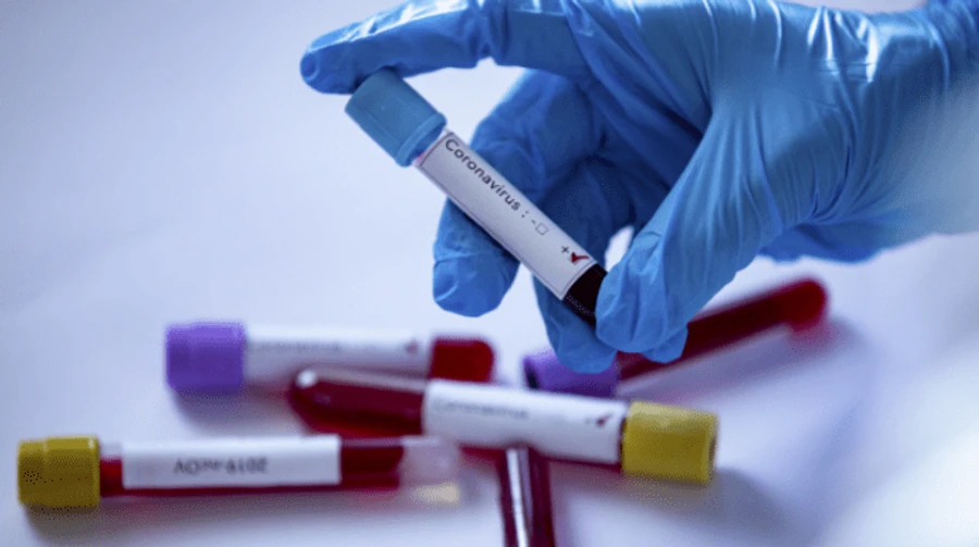 COVID: Понад 500 тисяч випадків у світі, найбільше в США та Туреччині