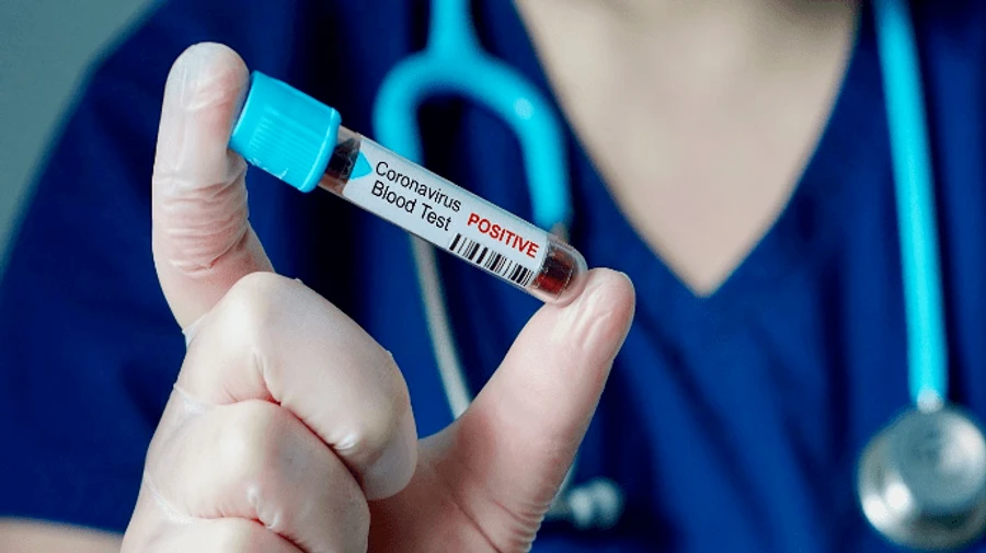 У світі зареєстрували найменшу за місяць кількість хворих на COVID-19