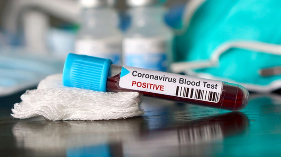 Індонезія стала лідером у світі за поширеністю COVID-19