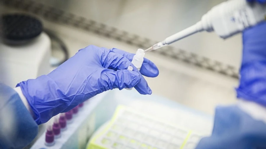 Швейцарія забезпечить громадян безкоштовними тестами на COVID