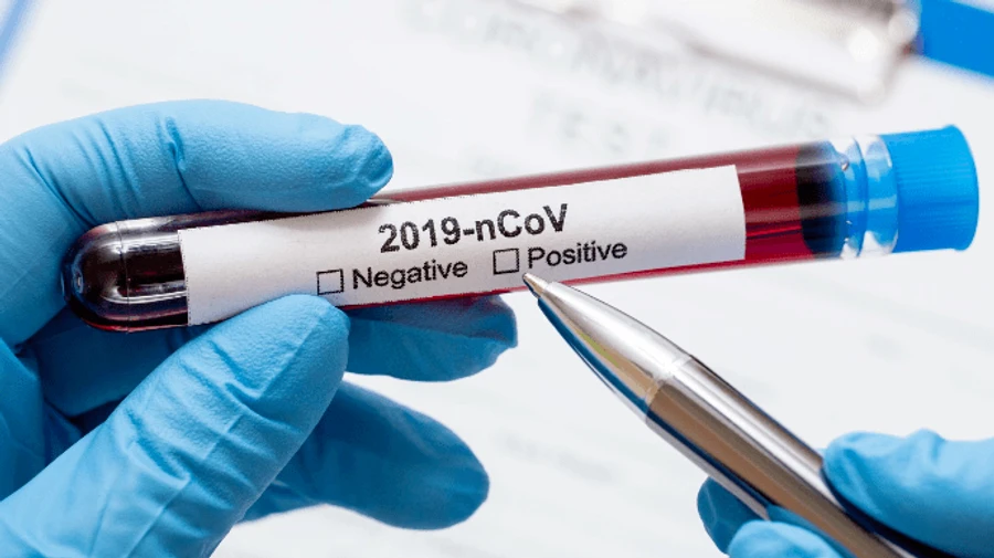 Літнім людям майже вдвічі простіше вдруге заразитися COVID-19, ніж молоді - Lancet